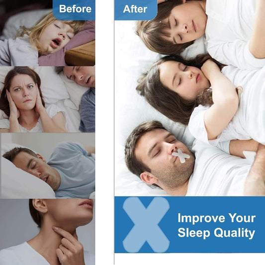 Anti‑Snoring Patch,Nasal Strips Mouth Strips for Sleeping